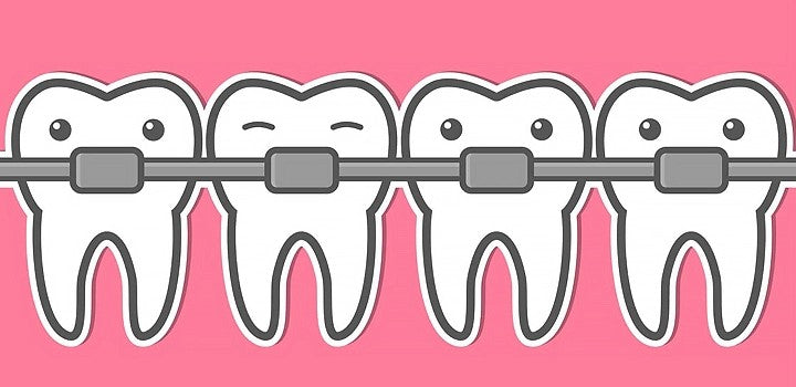 Triple Bristle Works With Braces